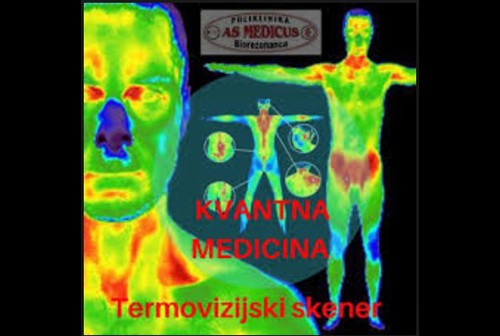 Poliklinika AS Medicus Biorezonanca - TERMOVIZIJSKI SKENER - 1